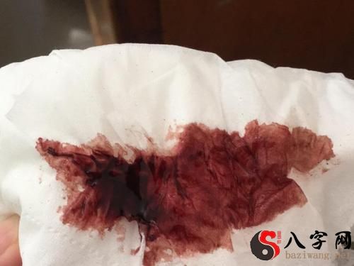 梦见自己下面流血