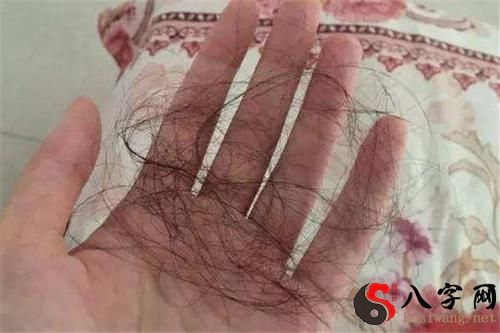 梦见自己头发掉了